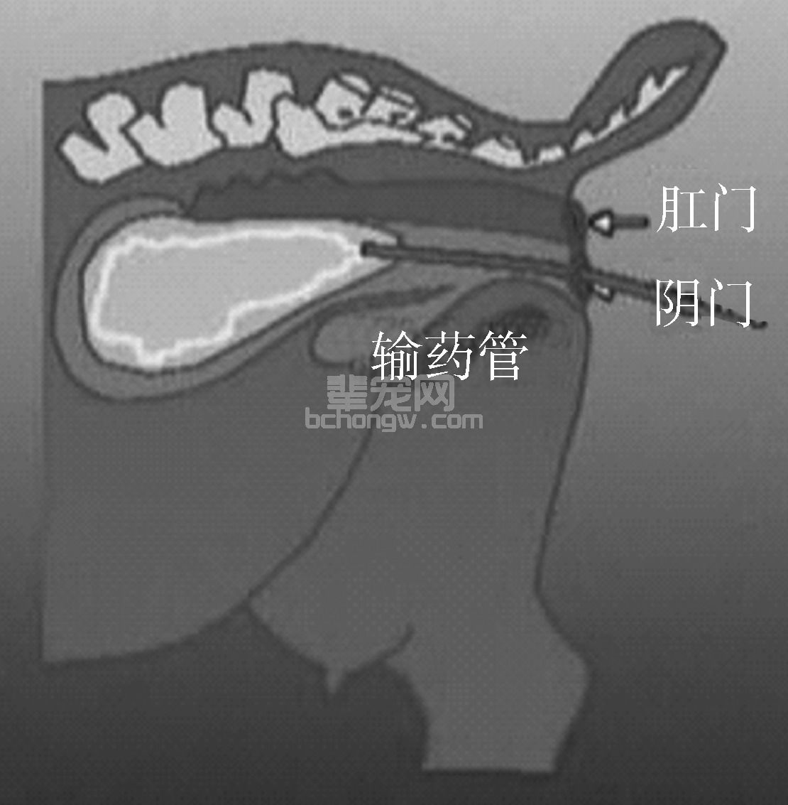 (四)子宫内膜炎