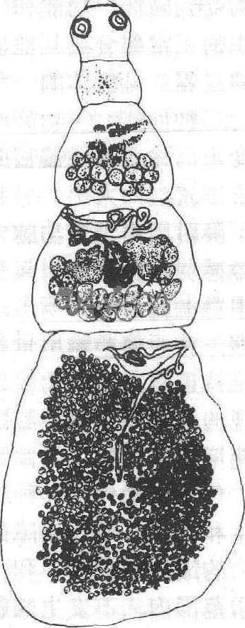 戴文绦虫病