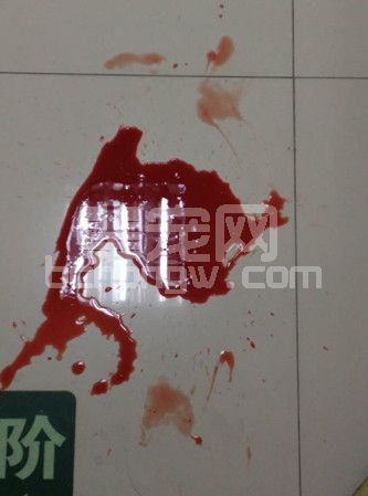 一例犬膀胱移行上皮细胞癌合并前列腺肥大病例的诊治