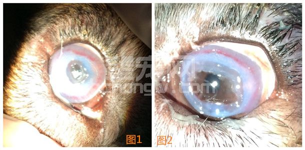 带蒂结膜瓣治疗深部角膜溃疡及角膜穿孔的报告
