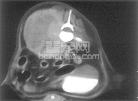 肿瘤的外科治疗原则