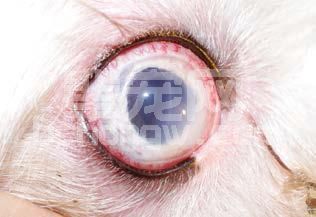 青光眼的药物和手术管理