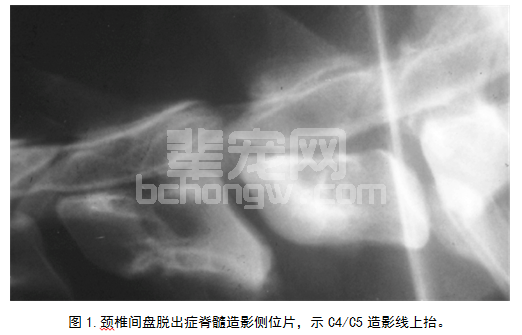 腹侧开槽术治疗犬颈椎间盘突（脱）出28例报道