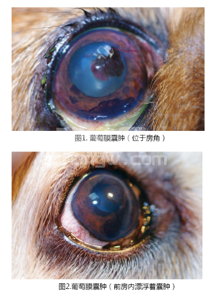 葡萄膜的解剖和常见疾病的诊治（二）