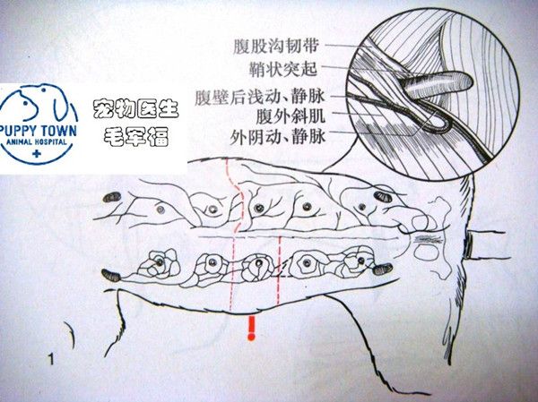 乳腺瘤切除，并不是那么简单