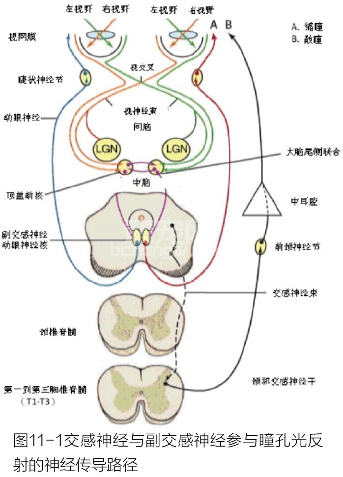瞳孔大小不等