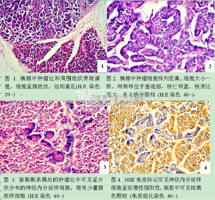 犬胰腺腺泡细胞癌伴发神经内分泌细胞分化的病理学观