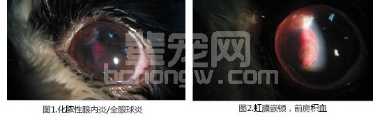 浅谈眼内炎的临床诊治