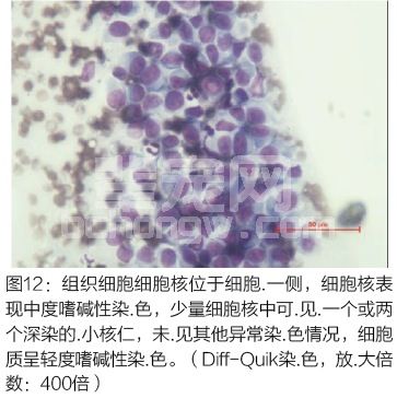 皮肤肿瘤的细胞学判读