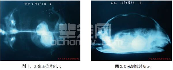 浅谈宠物苏卡达龟膀胱结石的防治