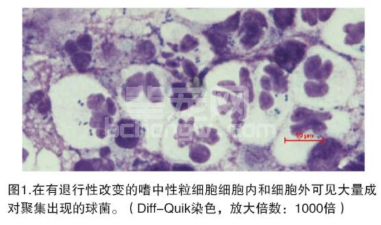 皮肤炎性病变的细胞学判读