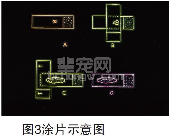肿瘤细胞学检查概论