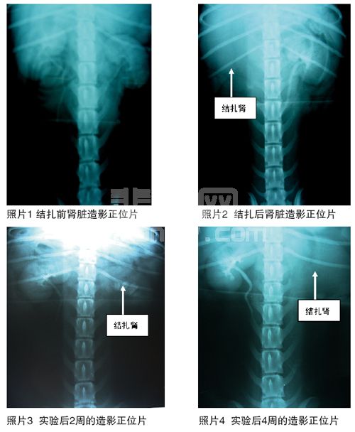 试验性犬单侧输尿管阻塞静脉肾盂造影前后