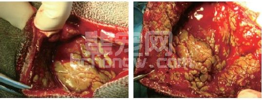 一例犬类皮窦并发海绵状淋巴管瘤的治疗