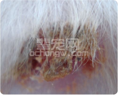 无菌性结节性脂膜炎