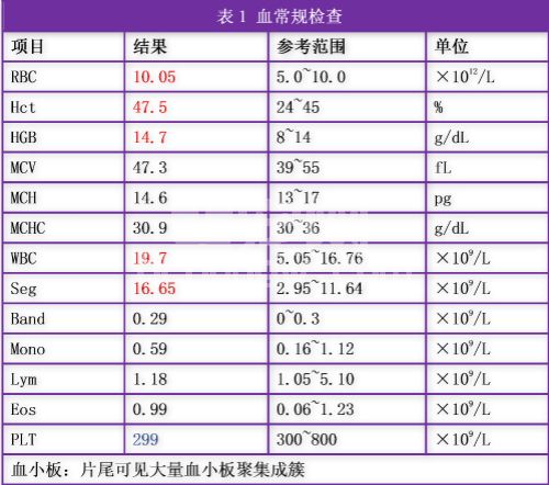 一例BNP辅助诊断猫心脏病的病例报道