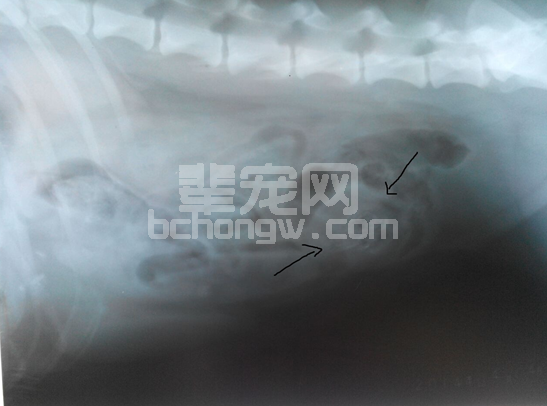 一例开放性缝合方法治疗的细菌性腹膜炎