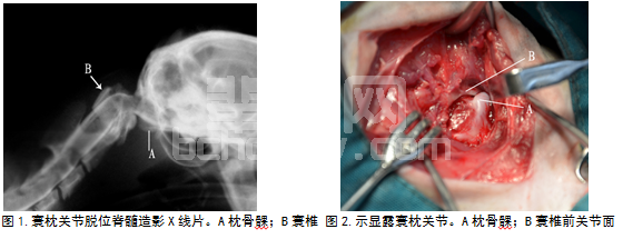猫寰枕关节脱位腹侧内固定
