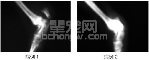犬跟骨骨折的手术治疗体会