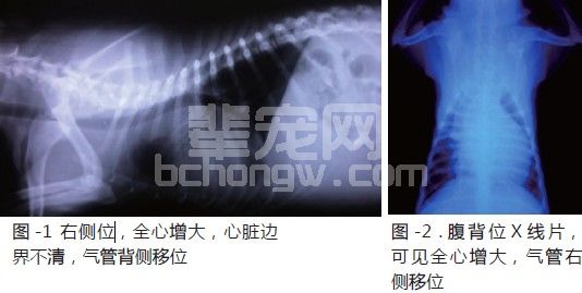 一例心基部肿瘤导致心包积液的诊断及治疗