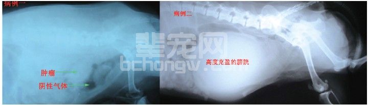 膀胱全切输尿管-直肠吻合术