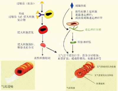 猫哮喘（FELINE ASTHMA）的诊疗研究现况