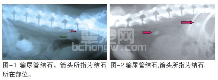 肾后性尿毒症