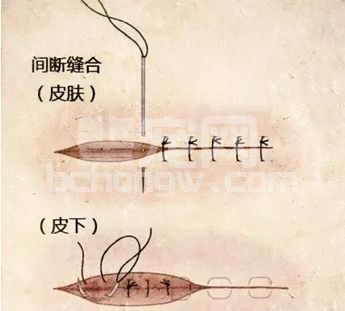 猪场技术 | 外科手术缝合你学会了吗?