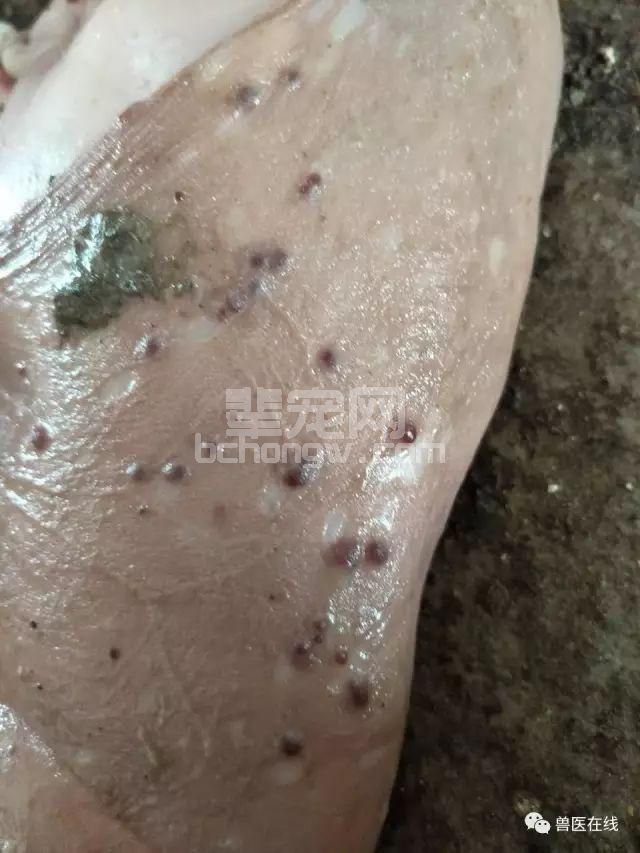看图说病：通过流产的胎衣你能看到什么？