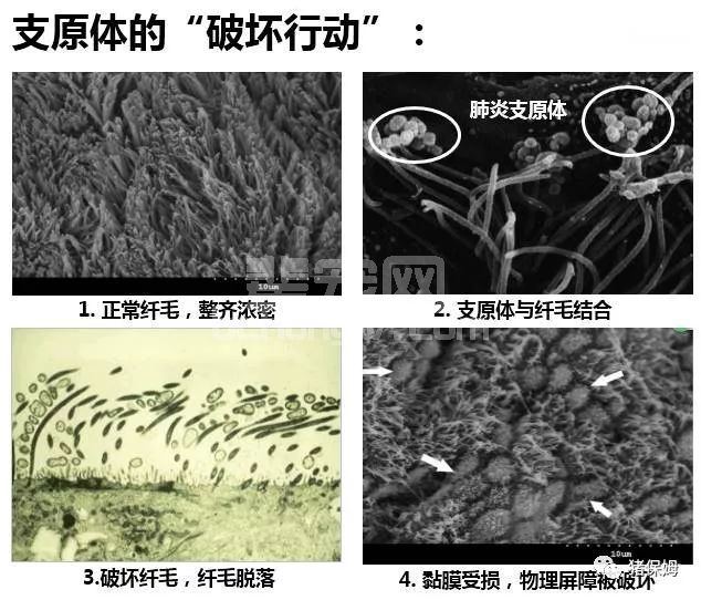 控制呼吸道必须净化此病，否则很难办！