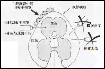 你真的会给猪打针吗？有图有真相！