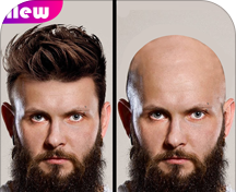 Baldlogo图